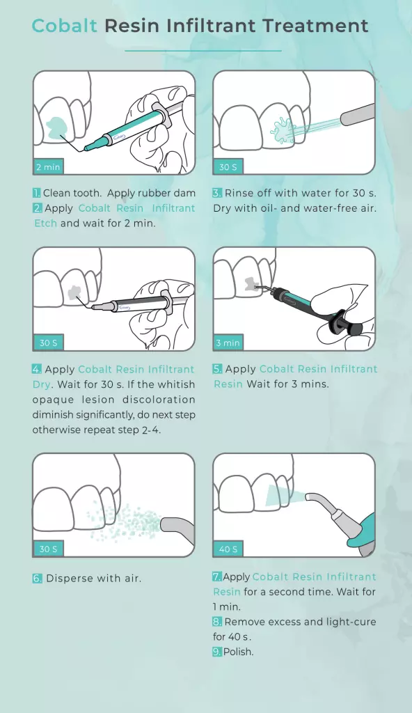 کیت رزین اینفیلترانت - کبالت بایومد