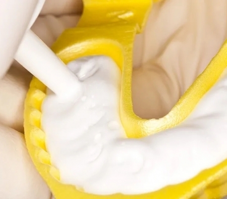 تری فلورایدتراپی یکبارمصرف کوتیزن Cotisen - تری یکبارمصرف فومی فلوراید کوتیزن Cotisen Disposable Fluoride Foam Trays تری فلورایدتراپی یکبارمصرف کوتیزن Cotisen - تری یکبارمصرف فومی فلوراید کوتیزن Cotisen Disposable Fluoride Foam Trays