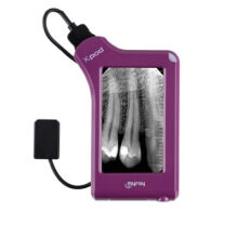 آرویجی RVG MYRAY XPOD - سنسور rvg مای ری My Ray مدل X-Pod سایز 1 - دستگاه RVG مای ری MyRay مدل X-Pod - RVG my ray مدل XPOD