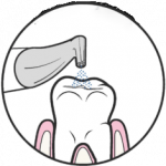 ایرفلو دندانپزشکی ? - خرید و قیمت و فروش دستگاه ایرفلو دندانپزشکی - جرمگیری دندان با ایرفلو