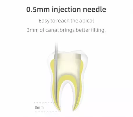 آبچوراتور بیسیم Woodpecker مدل Fi-G - آبچوراتور وودپیکر Woodpecker مدل Fi – G - آبچوراتور وودپیکر Woodpecker مدل FI-G - آبچوراتور Woodpecker مدل Fi-G آبچوراتور بیسیم Woodpecker مدل Fi-G - آبچوراتور وودپیکر Woodpecker مدل Fi – G - آبچوراتور وودپیکر Woodpecker مدل FI-G - آبچوراتور Woodpecker مدل Fi-G
